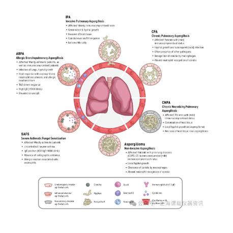 微生物動態(tài)監(jiān)測系統(tǒng)在開發(fā)治療曲霉病藥物中發(fā)揮哪些作用