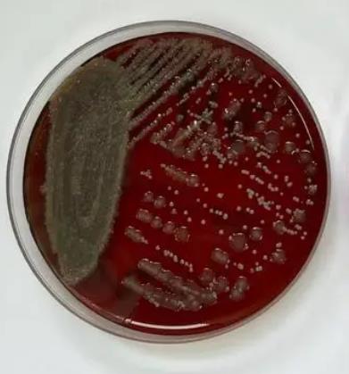 我國(guó)鹽堿土壤中細(xì)菌有哪些？如何分布的