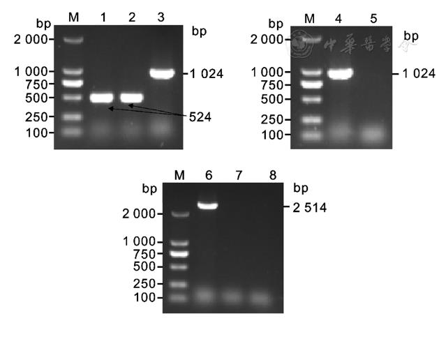 肺炎克雷伯菌vgrG基因缺失株構(gòu)建、體外生長能力測定（一）